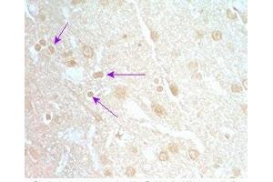Rat brain tissue was stained by Rabbit Anti-Neuromedin S Prepro (70-103) (Rat) Serum (NMS anticorps  (Preproprotein))