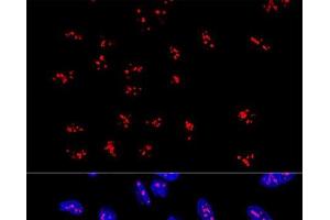 Confocal immunofluorescence analysis of U2OS cells using DDX21 Polyclonal Antibody at dilution of 1:100.