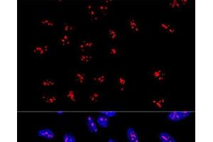Confocal immunofluorescence analysis of U2OS cells using DDX21 Polyclonal Antibody at dilution of 1:100. (DDX21 anticorps)