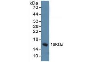 WB of Protein Standard: different control antibody against Highly purified E.