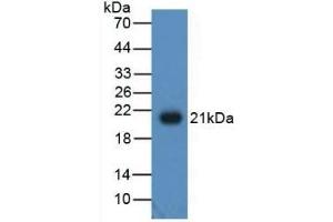 Detection of Recombinant ADP, Human using Polyclonal Antibody to Adiponectin (ADPN) (ADIPOQ anticorps  (AA 108-244))