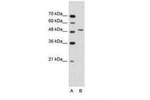 Image no. 3 for anti-Semenogelin I (SEMG1) (AA 51-100) antibody (ABIN203500) (SEMG1 anticorps  (AA 51-100))