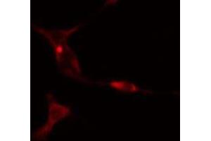 ABIN6275557 staining  COLO205 cells by IF/ICC.