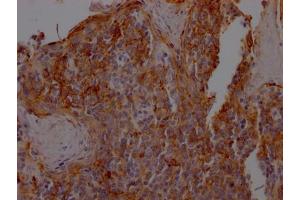 IHC image of ABIN7127559 diluted at 1:100 and staining in paraffin-embedded human tonsil tissue performed on a Leica BondTM system.