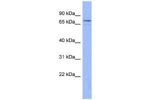 WB Suggested Anti-PATZ1 Antibody Titration:  0.