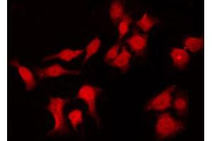 ABIN6266566 staining HuvEc by IF/ICC.