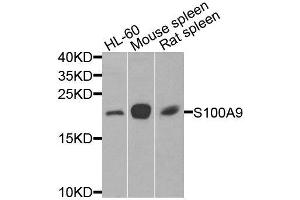 Western blot analysis of extracts of various cell lines, using S100A9 antibody (ABIN6003574) at 1/1000 dilution. (S100A9 anticorps)