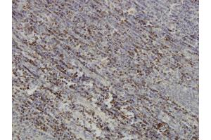 Immunoperoxidase of monoclonal antibody to PAX5 on formalin-fixed paraffin-embedded human tonsil.