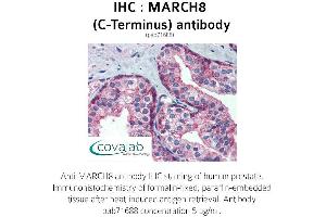 Image no. 2 for anti-Membrane-Associated Ring Finger (C3HC4) 8, E3 Ubiquitin Protein Ligase (MARCH8) (C-Term) antibody (ABIN1736759)