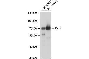 Western blot analysis of extracts of various cell lines, using  antibody (ABIN7265612) at 1:1000 dilution. (ASB2 anticorps  (AA 448-587))