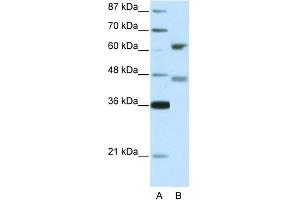 Human 293T; WB Suggested Anti-RFX4 Antibody Titration: 5. (RFX4 anticorps  (Middle Region))