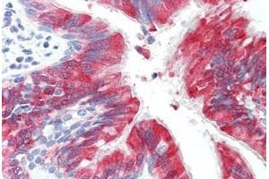 Human Lung, Respiratory Epithelium: Formalin-Fixed, Paraffin-Embedded (FFPE)