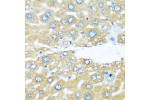 Immunohistochemistry of paraffin-embedded mouse liver using  antibody (ABIN6129195, ABIN6137096, ABIN6137097 and ABIN6220538) at dilution of 1:100 (40x lens). (ARHGEF5 anticorps  (AA 1248-1597))