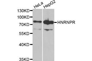 Western blot analysis of extracts of HeLa and HepG2 cell lines, using HNRNPR antibody. (HNRNPR anticorps)