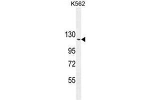 ARHGAP17 Antibody (N-term) western blot analysis in K562 cell line lysates (35µg/lane). (ARHGAP17 anticorps  (N-Term))