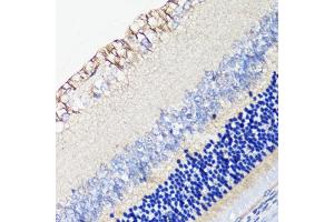 Immunohistochemistry of paraffin-embedded rat retina using DRD4 antibody (ABIN1679595, ABIN5663875, ABIN5663877 and ABIN6217338) at dilution of 1:100 (40x lens). (DRD4 anticorps  (AA 100-200))