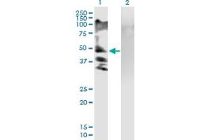 Western Blot analysis of RSC1A1 expression in transfected 293T cell line by RSC1A1 MaxPab polyclonal antibody. (RSC1A1 anticorps  (AA 1-617))
