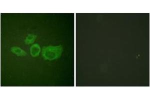 Immunofluorescence analysis of HuvEc cells, using Tyrosine Hydroxylase (Ab-40) Antibody.