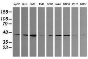 Image no. 2 for anti-Calreticulin 3 (CALR3) antibody (ABIN1497079) (Calreticulin 3 anticorps)