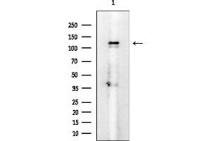 anti-Erythrocyte Membrane Protein Band 4.1 Like 3 (EPB41L3) antibody