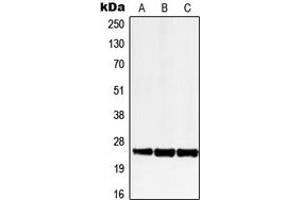 Western blot analysis of LRAT expression in HEK293T (A), SP2/0 (B), H9C2 (C) whole cell lysates. (LRAT anticorps  (Center))