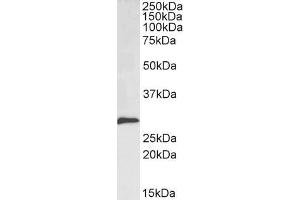 ABIN185704 (0. (SNAIL anticorps  (N-Term))