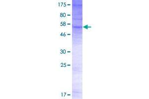 Image no. 1 for Organic Solute Transporter alpha (OSTALPHA) (AA 1-340) protein (GST tag) (ABIN7595982)