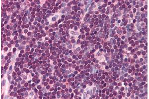 Human Small Intestine, Peyer's Patch (formalin-fixed, paraffin-embedded) stained with IRF8 antibody ABIN214504 at 5 ug/ml followed by biotinylated goat anti-rabbit IgG secondary antibody ABIN481713, alkaline phosphatase-streptavidin and chromogen. (IRF8 anticorps  (C-Term))