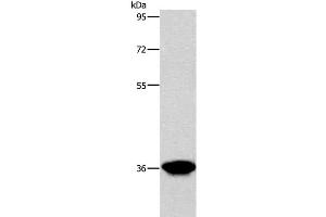 Western Blot analysis of Human liver cancer tissue using AKR1D1 Polyclonal Antibody at dilution of 1:650 (AKR1D1 anticorps)