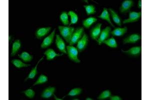 Immunofluorescence staining of A549 cells with ABIN7164376 at 1:166, counter-stained with DAPI. (DHX34 anticorps  (AA 418-554))