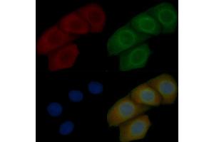 TOM40 Mouse Monoclonal Antibody staining Hela cells by IF/ICC. (TOMM40 anticorps  (Internal Region))