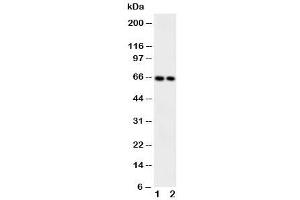 Western blot testing of CaMKK2 antibody and Lane 1:  rat brain (CAMKK2 anticorps  (Middle Region))
