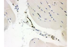 IHC testing of FFPE mouse skeletal muscle with CTBP2 antibody. (CTBP2 anticorps  (AA 321-445))