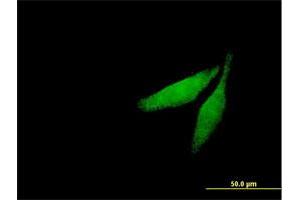 Immunofluorescence of purified MaxPab antibody to CAMK2G on HeLa cell. (CAMKII gamma anticorps  (AA 1-527))