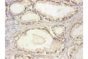 Immunohistochemical of paraffin-embedded human prostate tissue using ABIN7148973 at dilution of 1:200 (CST3 anticorps)