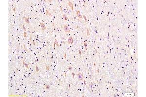 Formalin-fixed and paraffin embedded rat brain tissue labeled with Anti-DRD1 Polyclonal Antibody, Unconjugated  at 1:300, followed by conjugation to the secondary antibody and DAB staining (Dopamine Receptor d1 anticorps  (AA 101-200))