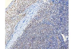 IHC analysis of HnRNP H/HNRNPH1 using anti-HnRNP H/HNRNPH1 antibody (ABIN4886623). (HNRNPH1 anticorps  (N-Term))