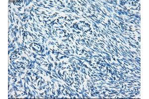 Immunohistochemical staining of paraffin-embedded colon tissue using anti-SORDmouse monoclonal antibody. (SORD anticorps)