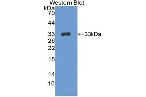 Detection of Recombinant BRCA1, Mouse using Polyclonal Antibody to Breast Cancer Susceptibility Protein 1 (BRCA1) (BRCA1 anticorps  (AA 1524-1781))