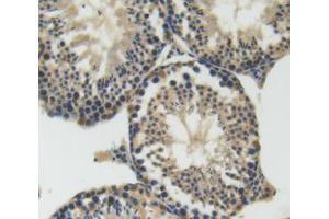 IHC-P analysis of testis tissue, with DAB staining. (SEMA4D/CD100 anticorps  (AA 502-636))