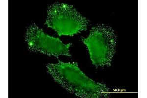 Immunofluorescence of monoclonal antibody to SH2D3C on HeLa cell. (SH2D3C anticorps  (AA 1-110))
