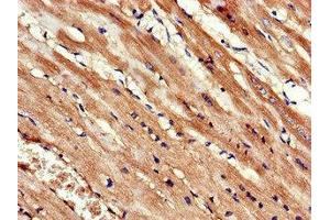 Immunohistochemistry of paraffin-embedded human heart tissue using ABIN7157595 at dilution of 1:100