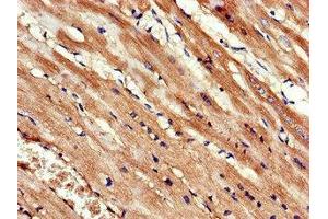 Immunohistochemistry of paraffin-embedded human heart tissue using ABIN7157595 at dilution of 1:100 (KIF14 anticorps  (AA 261-531))