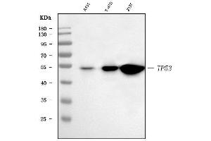 Western blot analysis of TP53 using anti-TP53 antibody (ABIN7599050).