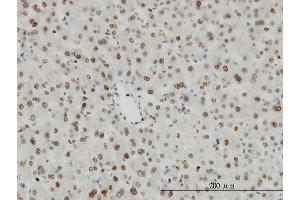 Immunoperoxidase of monoclonal antibody to HDAC1 on formalin-fixed paraffin-embedded human liver. (HDAC1 anticorps  (AA 1-482))