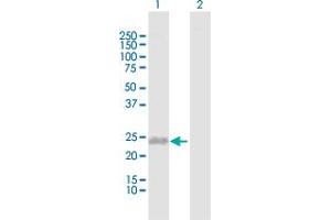 Western Blot analysis of C1QC expression in transfected 293T cell line by C1QC MaxPab polyclonal antibody.