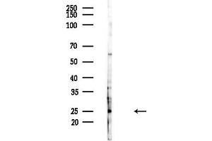 Western blot analysis of lysates from Hela cells(heat-shock,45 min treatment), using APOBEC3A/B Antibody at 1/1000 dilution. (APOBEC3A/B anticorps  (Internal Region))