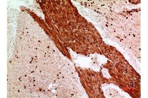 Immunohistochemistry (IHC) analysis of paraffin-embedded Mouse Heart, antibody was diluted at 1:100.