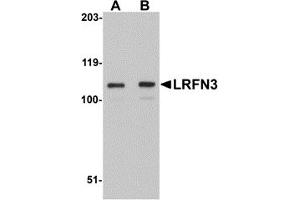 Western Blotting (WB) image for anti-Leucine Rich Repeat and Fibronectin Type III Domain Containing 3 (LRFN3) (Middle Region) antibody (ABIN1030988)