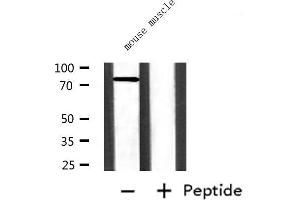 Western blot analysis of extracts from mouse muscle, using ZYX  Antibody. (ZYX anticorps  (Internal Region))